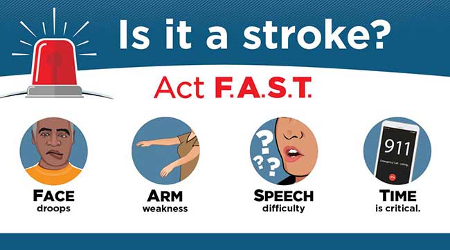 Act FAST and call 911 at first signs of stroke